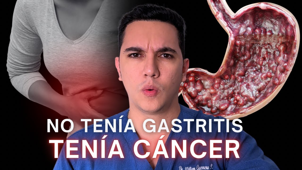 Creyó que tenía gastritis y resulto ser cáncer de estómago. ¡Que no te pase! | Dr. William Guerrrero