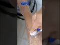 Naturally Hair Removal At Home🏡Unwanted Body Hair Removal Easy Remedy #hairremoval #ytshorts