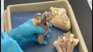 Details Heart Part II Update