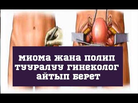 Video: Менопаузадан кийин гинекологго кайрылуум керекпи?