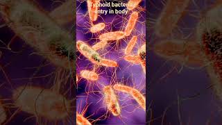 Typhoid Fever Typhoid Salmonella Typhi Salmonella