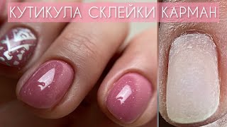 ПРИЛИПШАЯ КУТИКУЛА СКЛЕЙКИ КАРМАН СТЕМПИНГ МАНИКЮР НА КЛИЕНТЕ