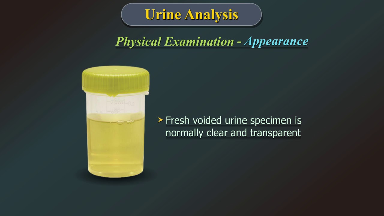  Urine  Analysis YouTube
