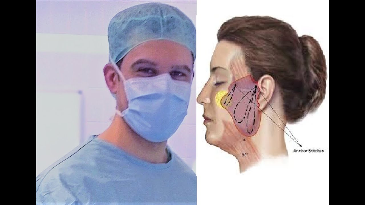 ΧΕΙΡΟΥΡΓΙΚΟ ΛΙΦΤΙΝΓΚ ΠΡΟΣΩΠΟΥ & ΛΑΙΜΟΥ - Δρ. Έκτορας Χατζηπαναγής