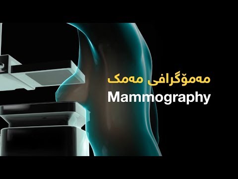 سۆنەری مەمک مەمۆگرافی کەی بۆ خانمان ئەنجام دەدرێت Mammography 