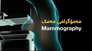 سۆنەری مەمک (مەمۆگرافی) کەی بۆ خانمان ئەنجام دەدرێت؟ Mammography screenshot 5