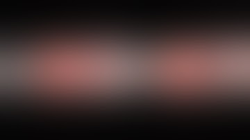 Dense Surface Reconstruction for Enhanced  Navigation in Minimally Invasive Surgery