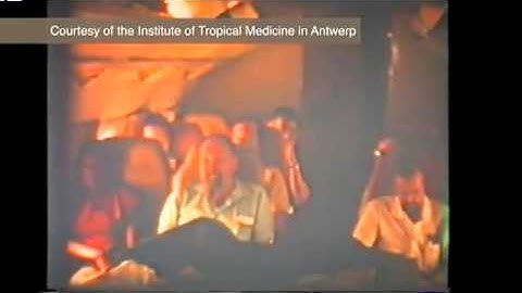 EBOLA 16; Congo -1976 ,The First Case