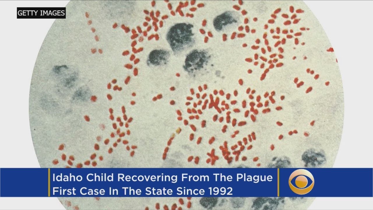 Idaho child diagnosed with plague; only 5th human case in state history