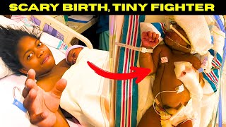 41 Hour Labor, NICU Stay, and a Life-Threatening Diagnosis – Our Birth Story