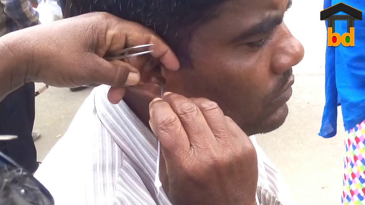 Regular Ear Wax Cleaning With Input GEL II Street Ear Waxing YouTube