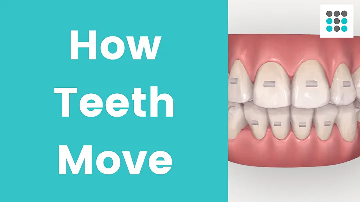HOW TEETH MOVE WITH ALIGNERS & BRACES l Dr. Meliss...