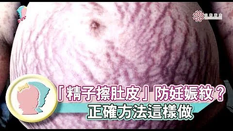 【妊娠紋】妊娠紋去去走！紅紋、白紋如何消除？｜陳志軒醫師｜禾馨形體美學｜寶貝幫X馨講堂 47 - 天天要聞