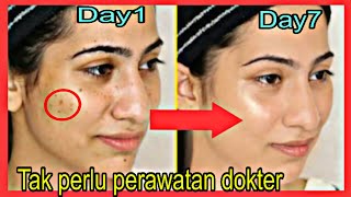 Tak Perlu Perawatan dokter!!Kerutan Wajah& Flekhitam hilang dengan  minyak zaitun