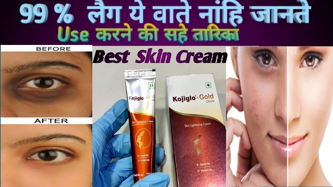 Kojiglo Gold Cream KojigloGold Cream Review Kojiglo Gold Skin