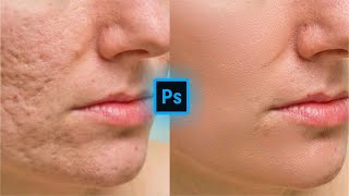 smoothen face in one minute || Photoshop tutorial