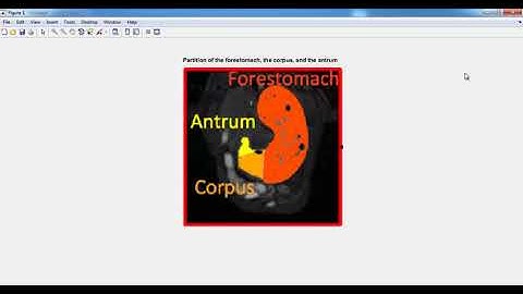 Contrast Enhanced Magnetic Resonance matlab projects