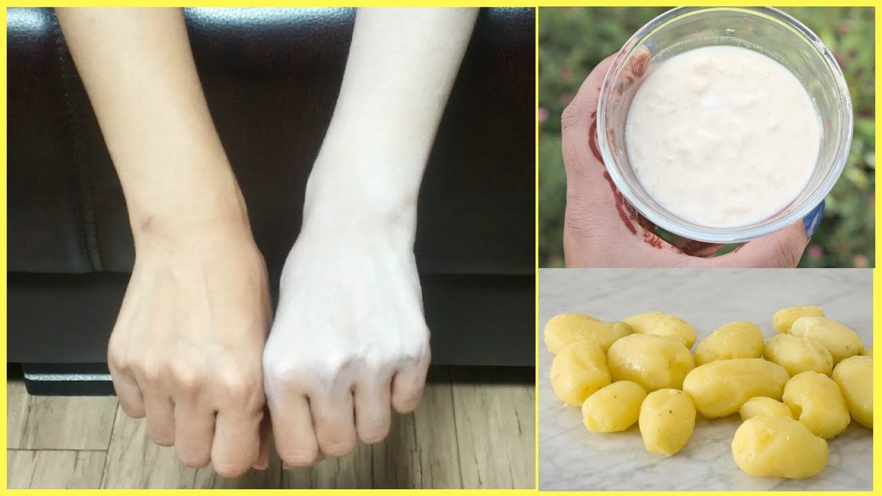 Permanent Skin Whitening Remedy with Boiled Potato | Remove Sun Tan | Get  Fair Skin in 10 Minutes - YouTube