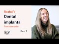 Rachel's Smile in a Day Dental Implants Journey - Part 2 - 'I Used to Use Filters To Cover My Smile'