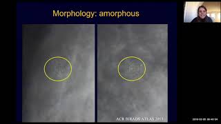 Breast Imaging Calcifications  module 5 | Health4TheWorld Academy