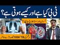 What Is Tuberculosis(TB)Symptoms & Treatment | TB Ki Alamat In Urdu | Tb Ka Ilaj | Dr Tariq Mehmood