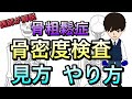 骨粗鬆症の検査！骨密度検査はどんな検査？どんな人がやるべき？検査の見方！