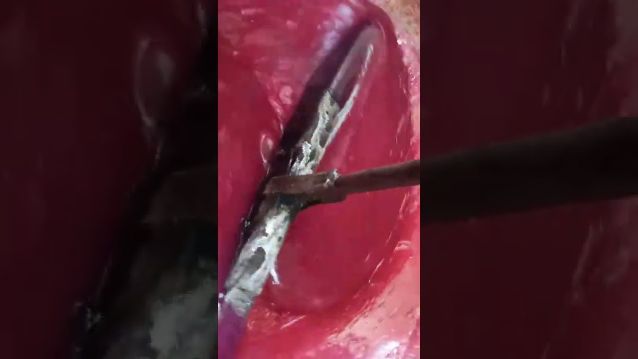 عمل الحلقوم الاحمر من المعمل مباشرتا