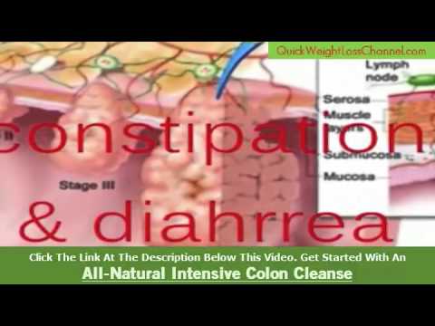 colon-cleansing-with-digestive-science-intensive-colon-cleanse