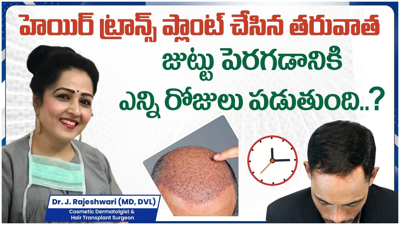 Hair Growth After Hair Transplant || Hair Transplant Treatment in Telugu || Dr Rajeshwari's Health