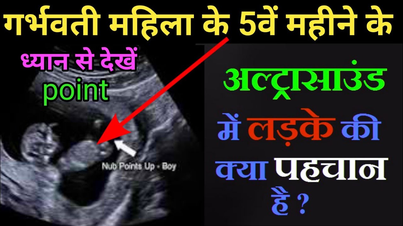 🤱 ️गर्भवती महिला खुद जाने गर्भ में पल रहा शिशु क्या होगा?Baby Boy