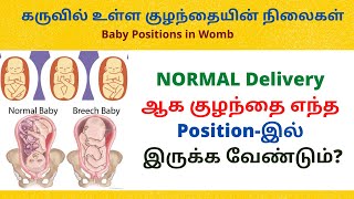 baby position in womb  tamil | different positions of baby during pregnancy in tamil | Malliga Tamil