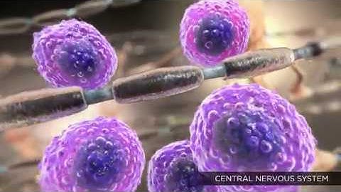 Multiple Sclerosis, the Role of B-Cells [HD]