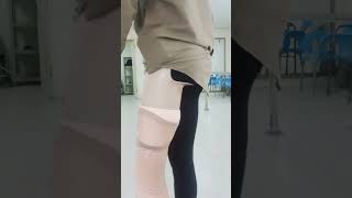 Trans femoral amputee walking 🦾🦿 #prosthetics #13million #foru #1milio#doctor #limbloss #ilimb