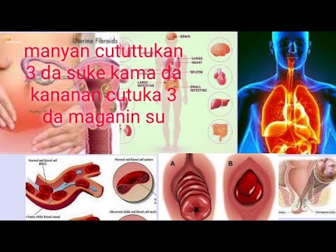 manyan cututtuka guda 3 masu kama da kananan cutuka tare da maganin su a saukake