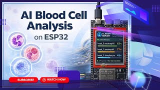 BIOScreen | AI-Integrated Embedded System for Real-Time Blood Cell Classification (FYP Project)