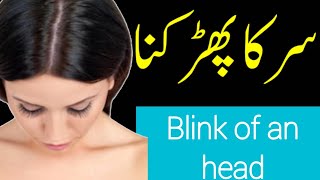 Sir ka phadakna fadakna Sir Ka left right Urdu Amliyat Hindi