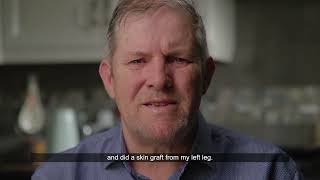 SunSmart Patient Skin Cancer Story: James's Story 2025