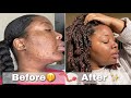 WHEW Get Into THE SKIN | My Updated Skincare Routine | Fading Dark Marks, Smooth Skin & More