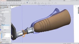 Using SOLIDWORKS & 3D Scanning for prosthetics design