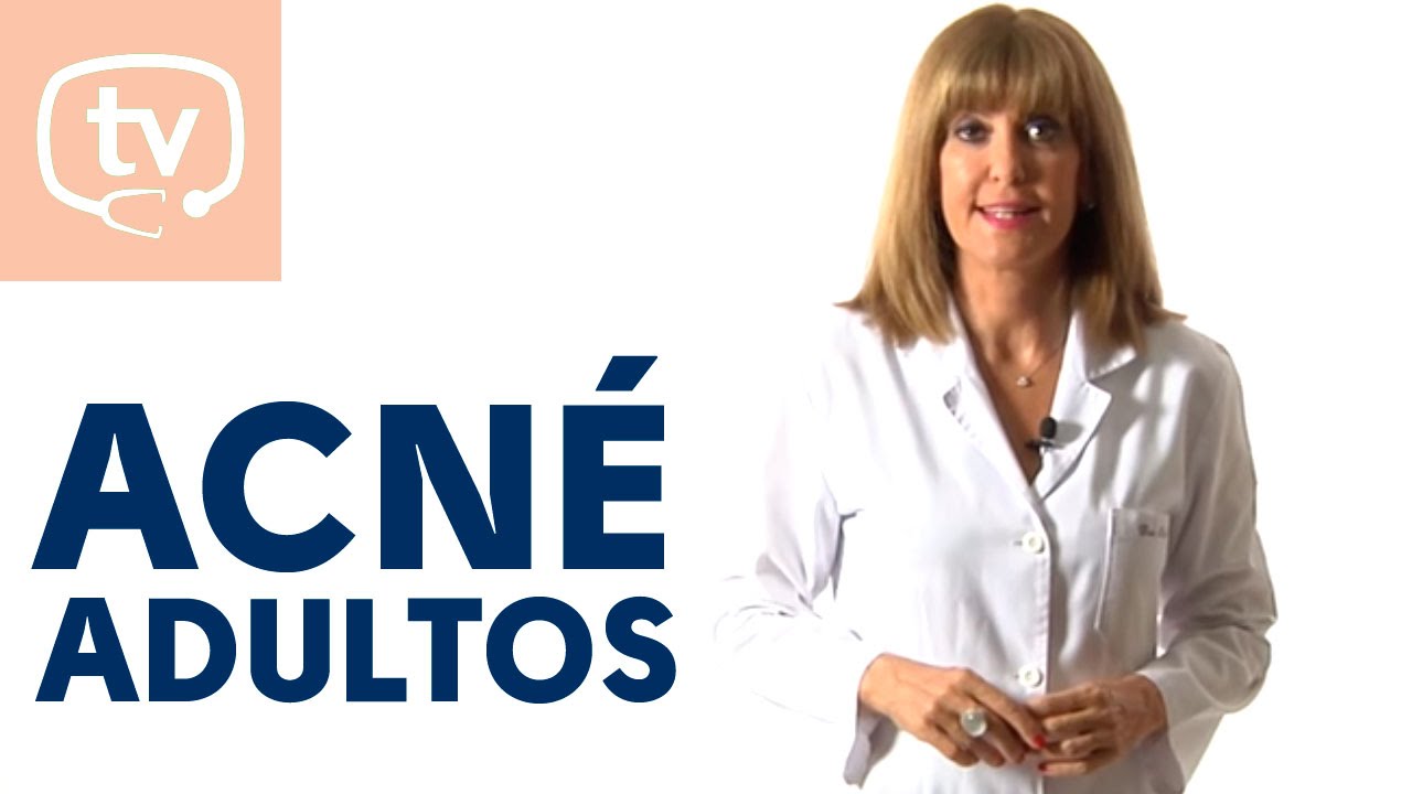 eliminar arrugas entrecejo remedios caseros Cómo tratar el acné del adulto