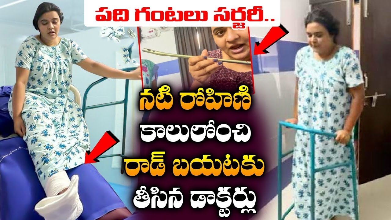 Jabardasth Rohini In Hospital | Actress Rohini Health Condition | Rohini Surgery Is Successful | TV