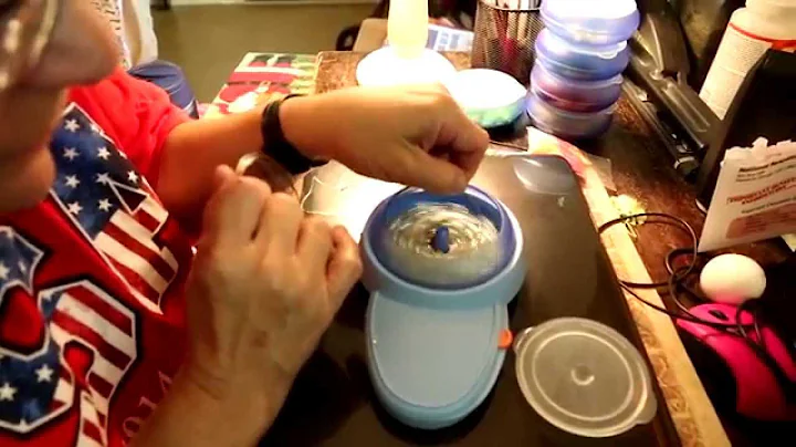 Deep Brain Stimulation Patient Story: Theresa Little