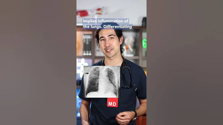 Cold or Pneumonia? Doctor Explains #pneumonia #flu #covid19