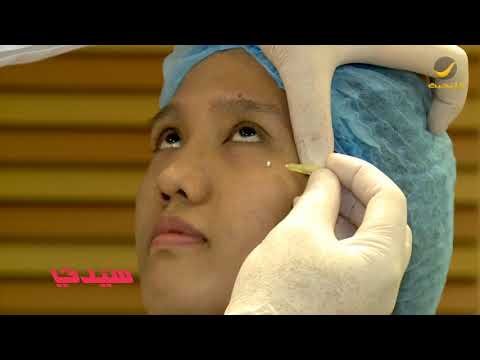 د سامح سالم يطلعنا على تقنية الخيوط التجميلية واستخداماتها