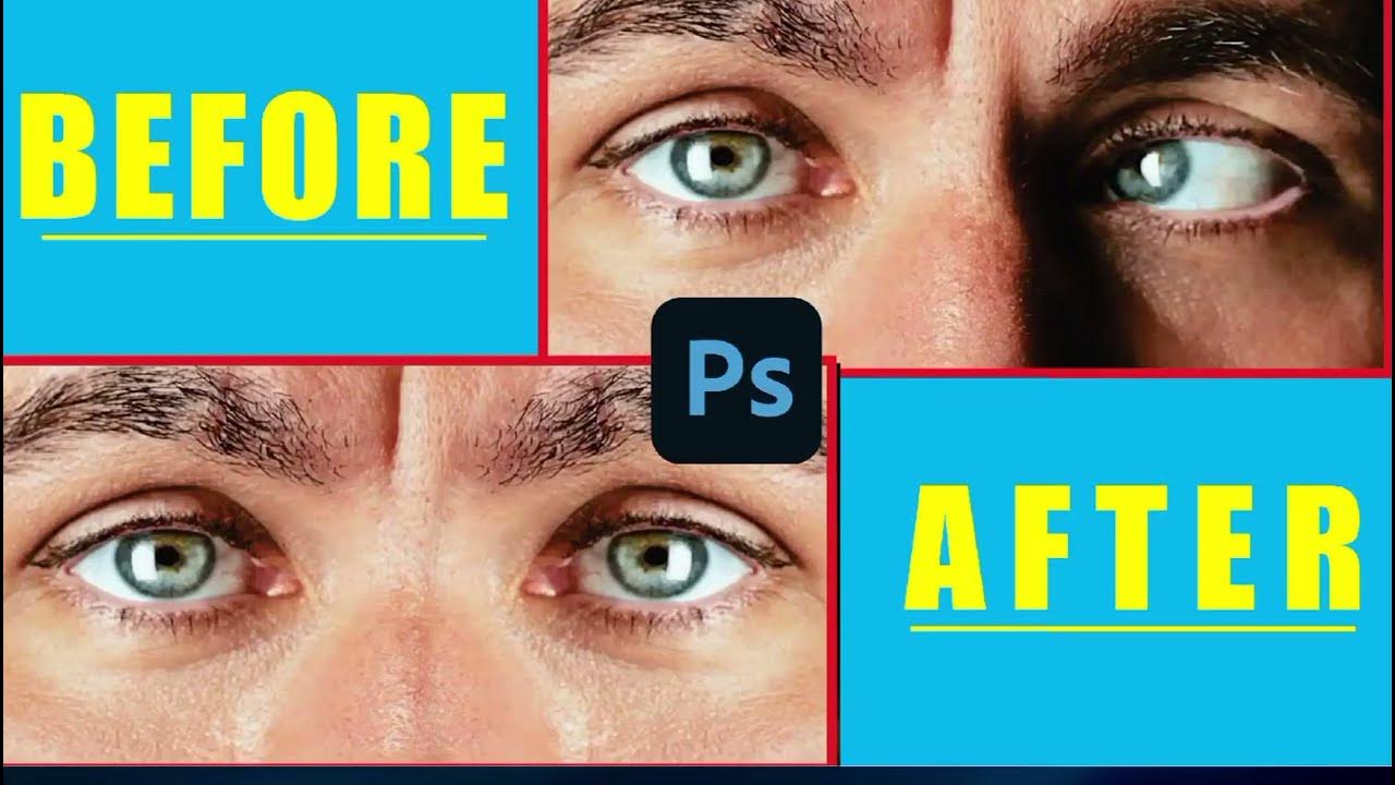 How to Fix Crossed Eyes in YouTube