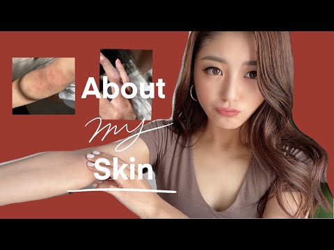 How I treat my atopic dermatitis / Skincare products ( ENG/JPN SUB )