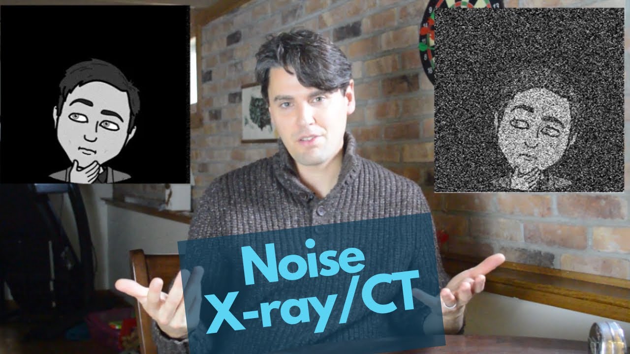 X-Ray Image Noise (Image Noise And Dose | Rad Techs)