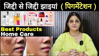 जदद स जदद झइय Pigmentation क लए सबस अचछ Products How To Treat Pigmentation At Home