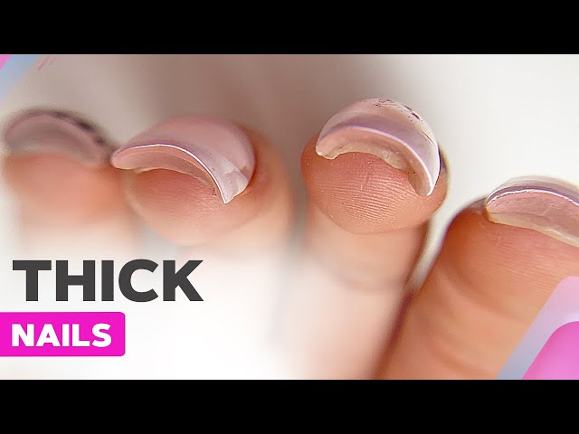 Thick Nails, Common Nail Extension Mistakes