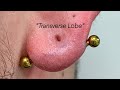 "TRANSVERSE LOBE PIERCING" 💉👂